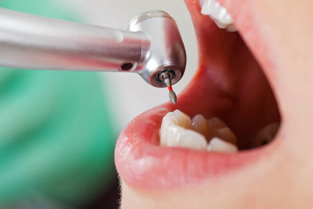 Best Emergency Denture Repair in Portland, MI